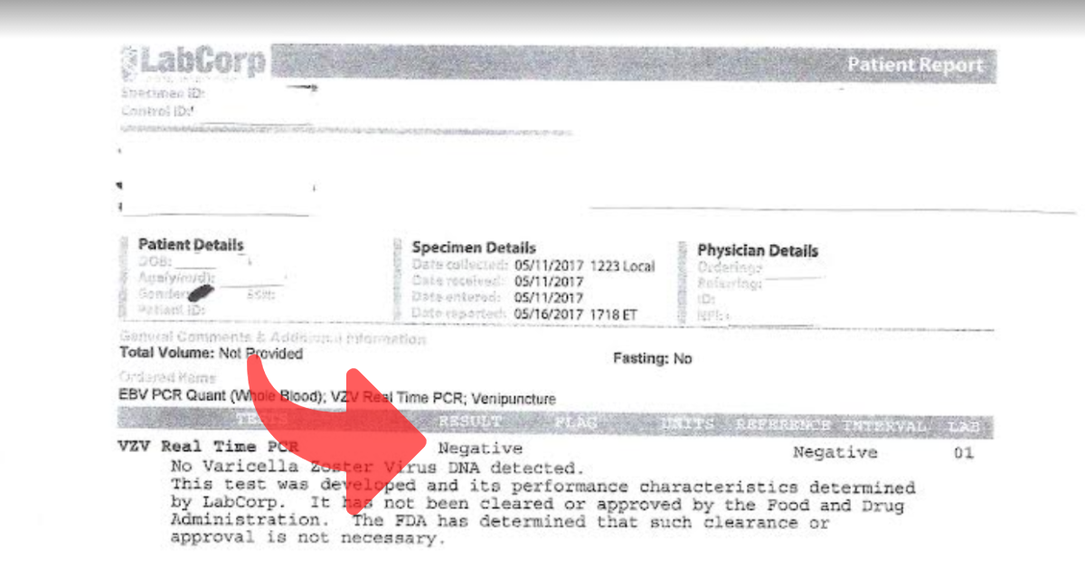 Shingles PCR test from Labcorp